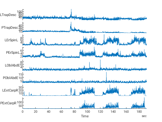 Celý EMG záznam tří pokusů vestoje. Na svislých osách: činnost v µV, na vodorovné ose: čas ve vteřinách