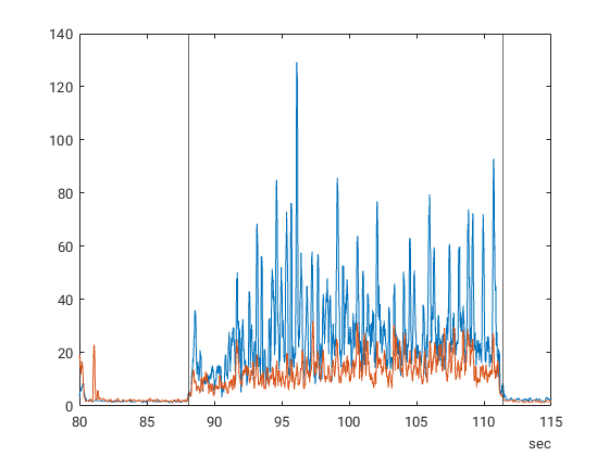 Činnost natahovačů zápěstí. Na svislé ose: činnost v µV, na vodorovné ose: čas ve vteřinách