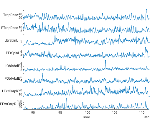 Část EMG záznamu vyňatá pro další zpracování. Na svislých osách: činnost v µV, na vodorovné ose: čas ve vteřinách