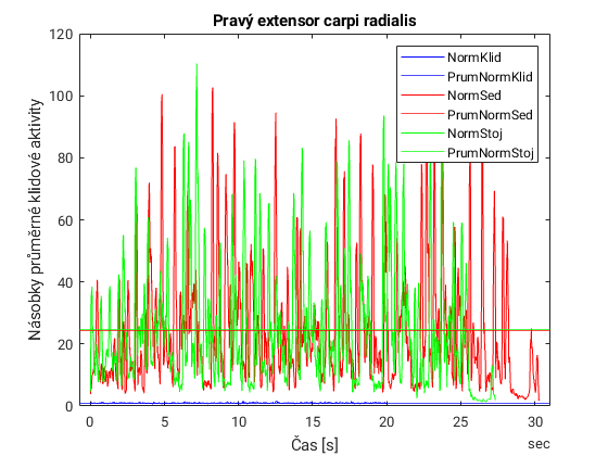 Vzor zobrazení okamžité a průměrné činnosti svalu v klidu, sedu a stoji