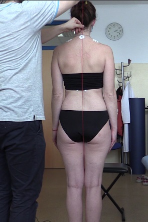 Vyšetření pomocí olovnice zezadu